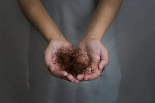 hairfall