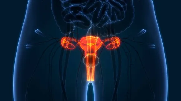 cervical cancer