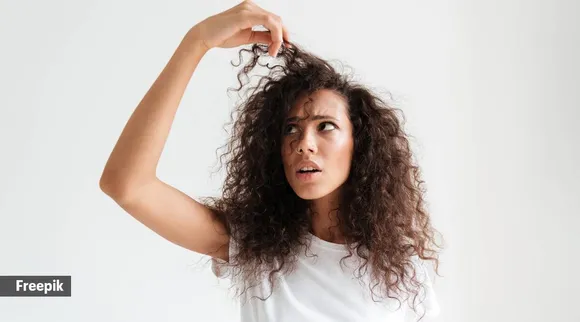 hair fall