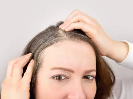 white hair
