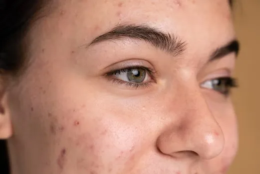 Pomegranate Peel Skin Care