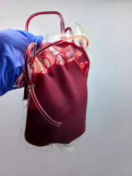 blood circulation