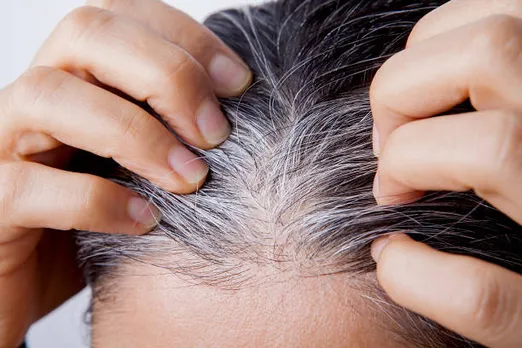 white hair