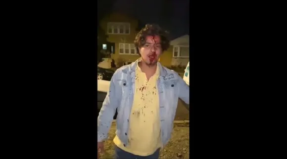 Indian student attacked in Chicago issues video plea Tamil News 