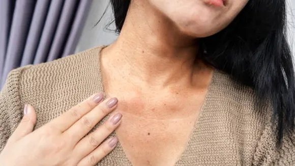dark spots