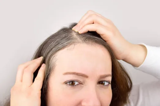 white hair