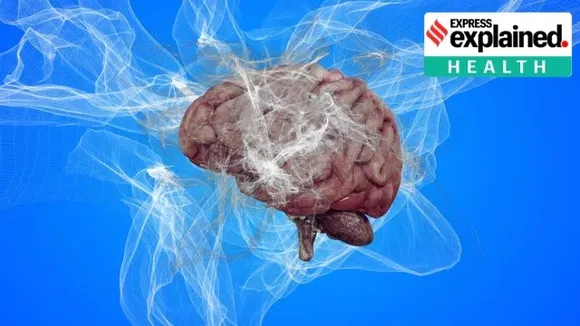 new Alzheimers drug
