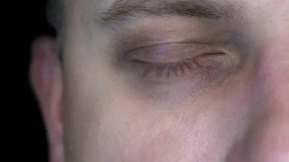 eye