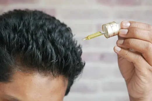 hairfall 