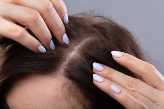 hair growth