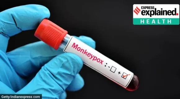 Mpox1