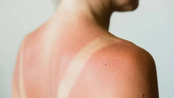 tanned skin