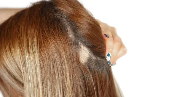 hair