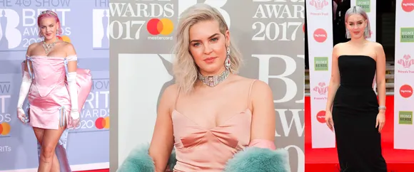 Anne-Marie And Her Impeccable Fashion!