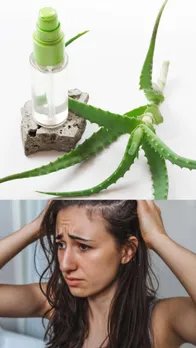 Lemon and aloe vera for dandruff