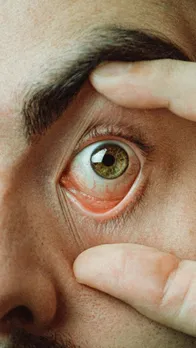 Triphala for Eyes