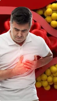 CHOLESTROL CONTROL MAIN