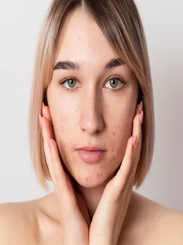 स्किन को नुकसान पहुंचा सकती है ये चीजें