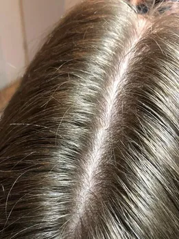 नये बाल उगाने के घरेलू उपाय