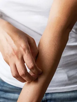 स्किन एलर्जी है तो भूल से भी ना खाएं ये चीजें, पड़ सकता है भारी