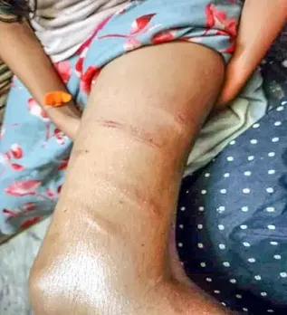 GIRL BEATEN