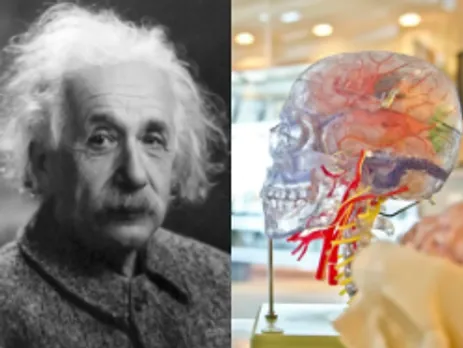 albert