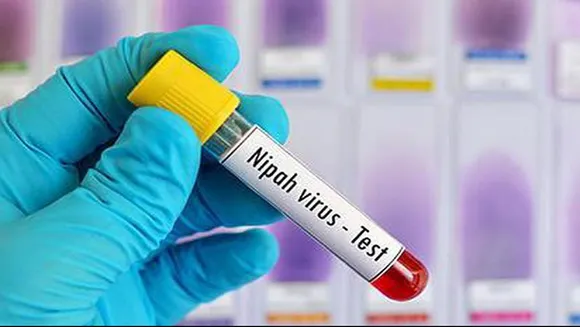 NIPHA VIRUS TEST