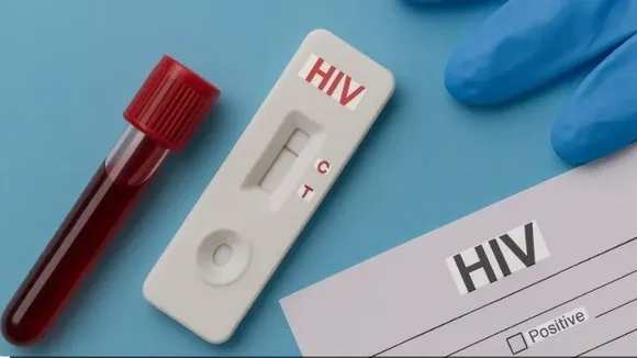 hiv