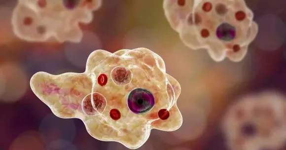 amoebic-encephalitis
