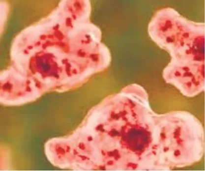 amoeba