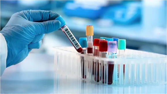labtest