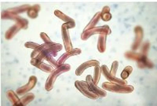 cholera