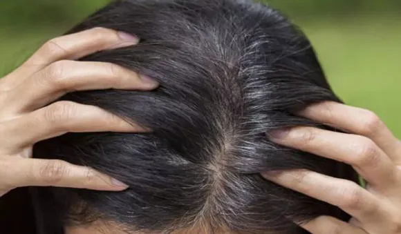 അകാലനര അകറ്റാം; ഈ ആറ് സിംപിള്‍ ടിപ്‌സിലൂടെ...