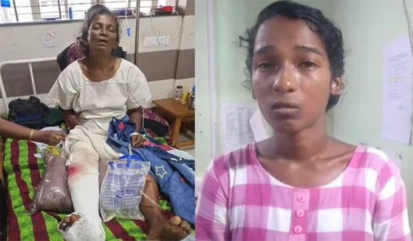  ആണ്‍വേഷം കെട്ടി വയോധികയുടെ കാല്‍ തല്ലിയൊടിച്ചു:മരുമകള്‍ പിടിയില്‍
