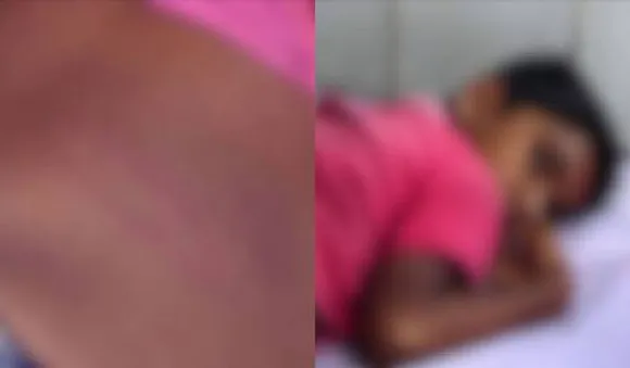 പുതുവത്സരാഘോഷം കാണാനെത്തിയ നാലാം ക്ലാസുകാരന് പൊലീസിന്റെ ലാത്തിയടി