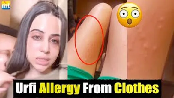 Shocking 😱 Urfi Javed wears Less Clothes because she has Allergy of this