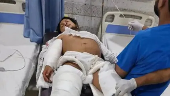 Pawandeep gets injured in accident