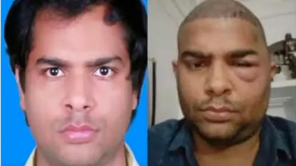 Kanpur Hair Transplant Death