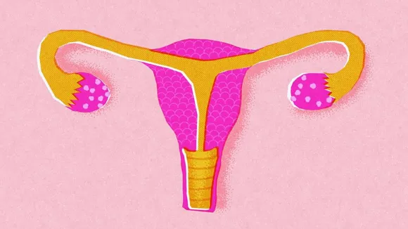 Hysterectomy Menstrual Hygiene Menstruation