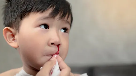 nosebleeding Blood