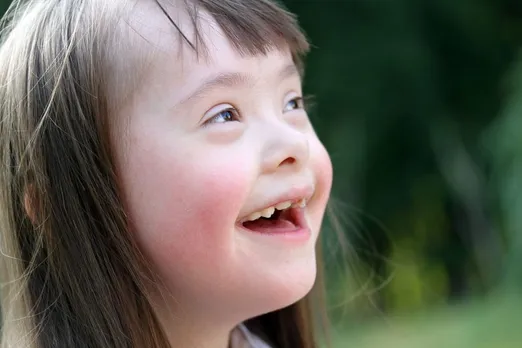 Premature aging in Down Syndrome.jpg