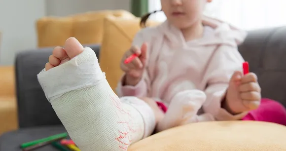broken_ankle_child