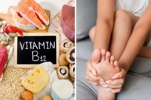 Vitamin-b12