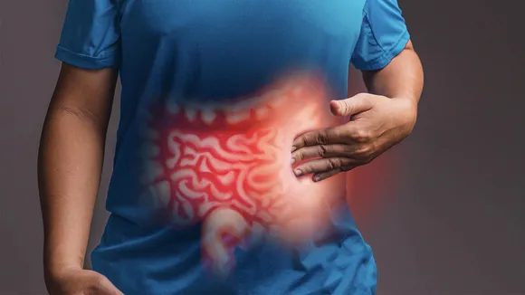 Inflammatory bowel disease.jpg