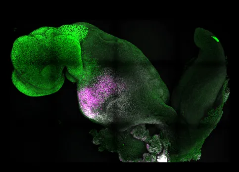 Human embryo model.jpeg