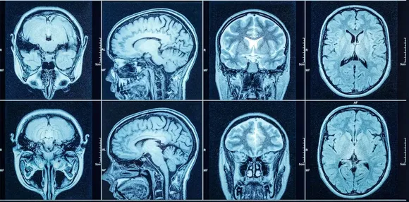 Long covid organ abnormalities.jpg