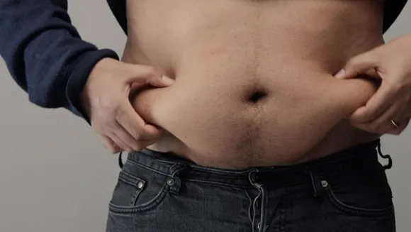 abdominal fat, obese, obesity fatty
