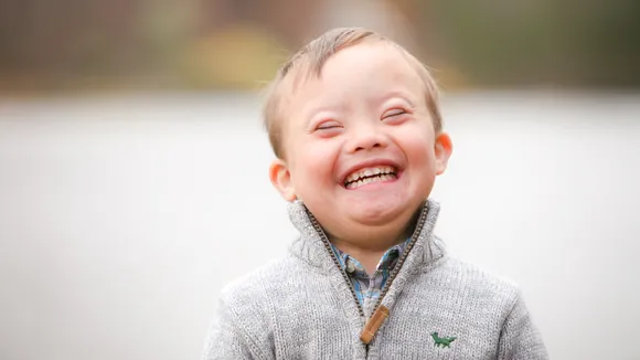 Down syndrome.jpg
