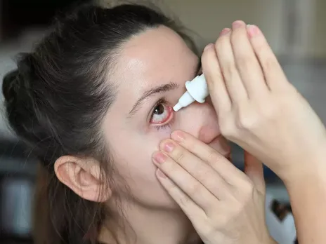 conjunctivitis.jpg