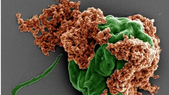 Part algae, part red blood cell, these microrobots can travel to hard-to-reach tumors deep in the lungs